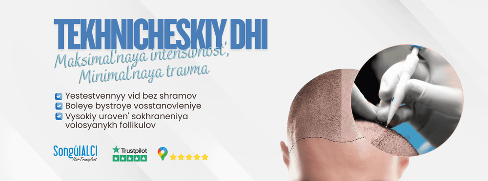 Songül Alcı Hair Transplantation Clinic Turkey